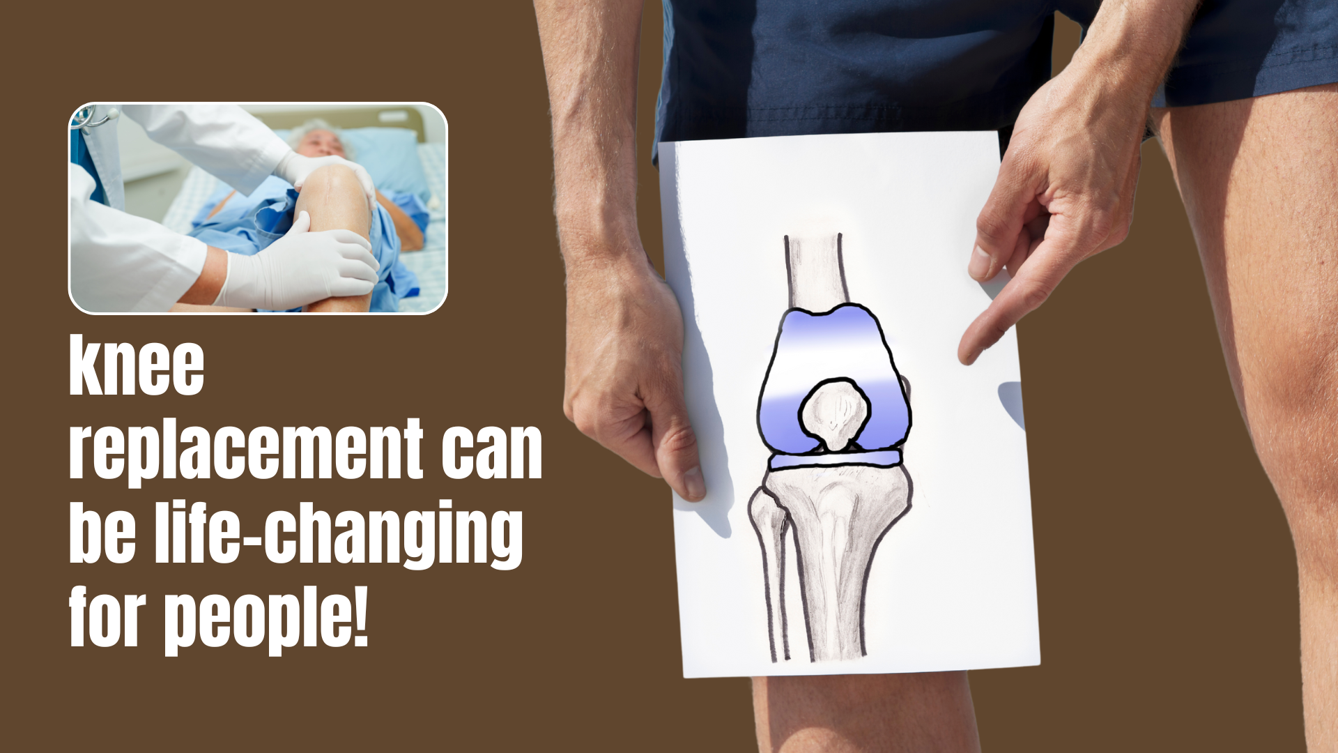 knee replacement can be life-changing for people!